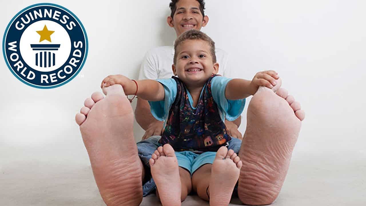  Le pied le plus long du monde mesure plus de 41 cm et appartient à un Vénézuélien.